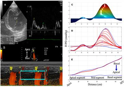 Novel color M-mode echocardiography for non-invasive assessment of the intraventricular pressure in goats: Feasibility, repeatability, and the effect of sedation